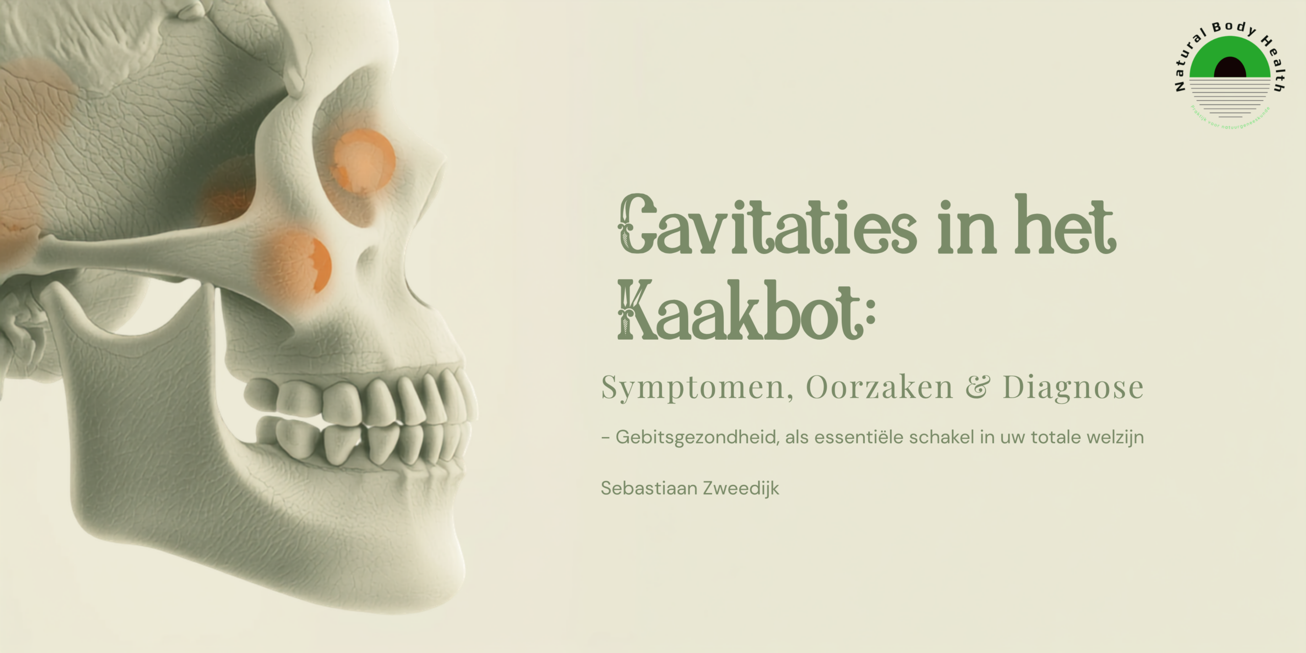 Cavitaties in het Kaakbot | Symptomen, Oorzaken & Diagnose